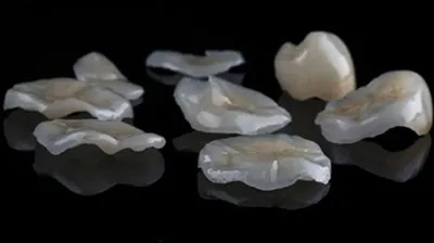 biomimetic dentistry products used to help restore teeth