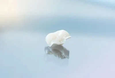 biomimetic sealants that help restore teeth